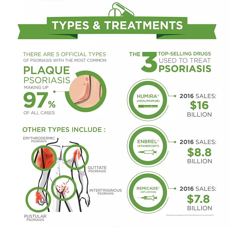 Psoriasis types of treatment